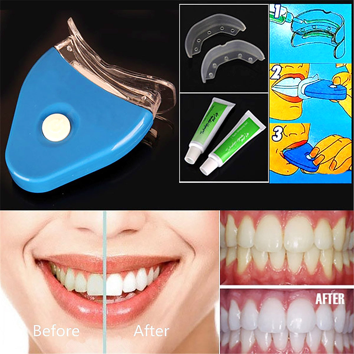 Oral Gel, Teeth Whitening Dental Bleaching LED